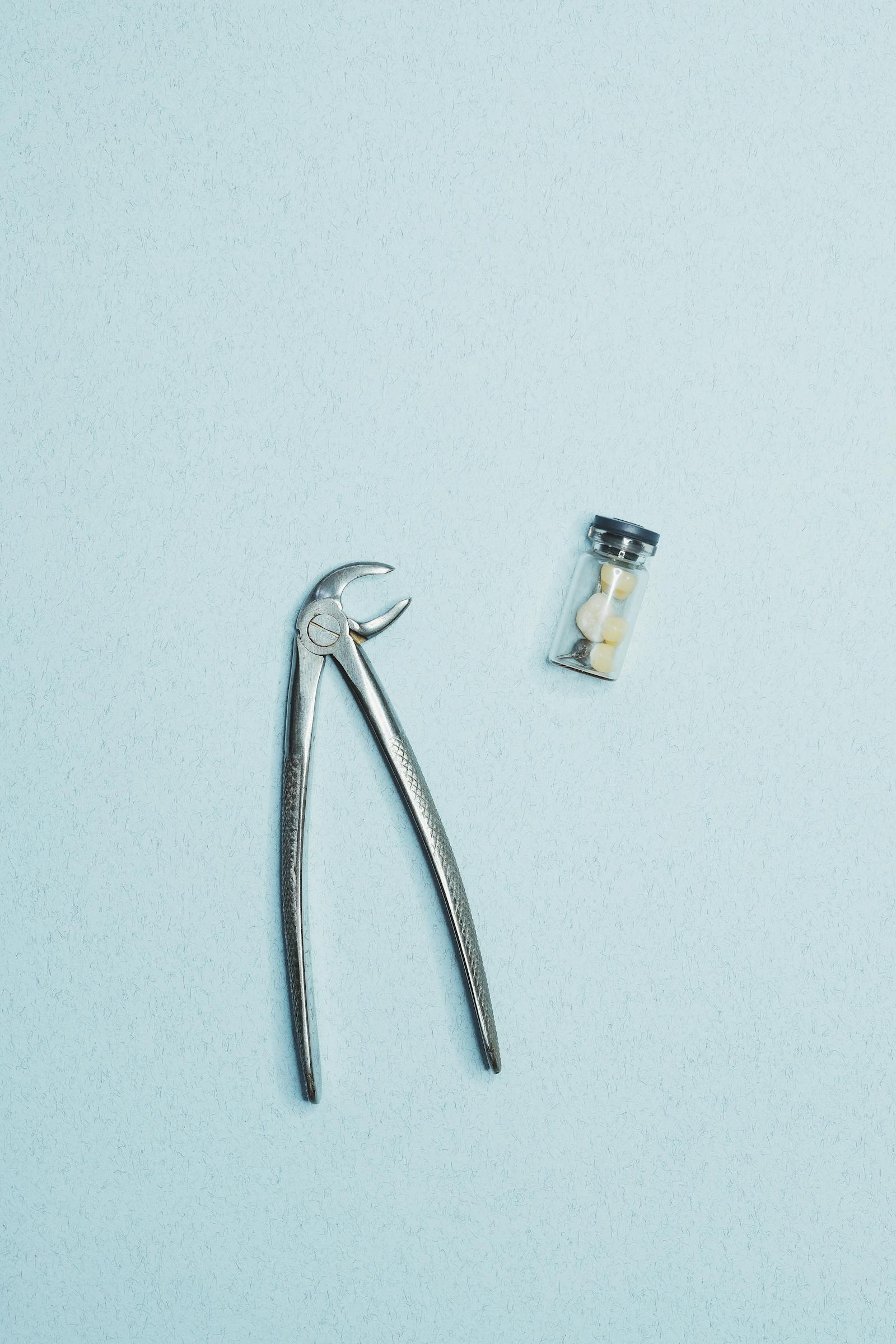 Gum-Impacted Wisdom Tooth Extraction