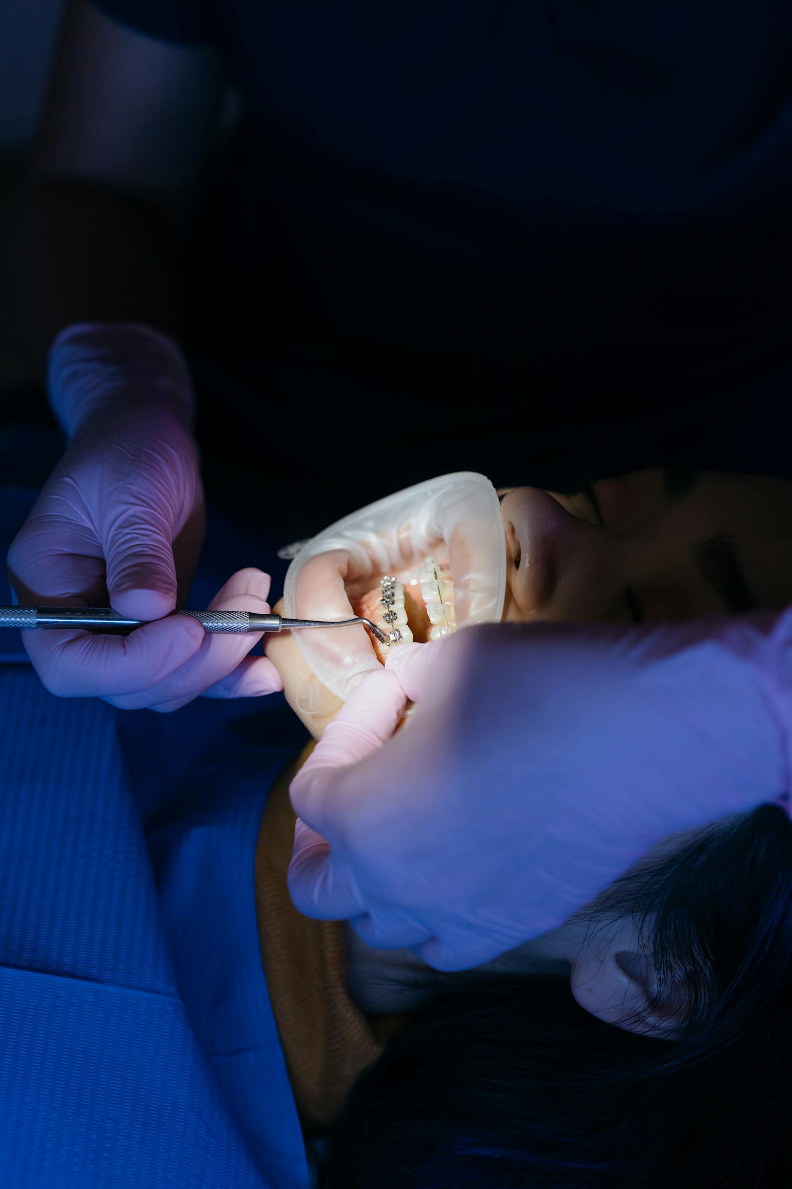 Dental Filling (Korean)