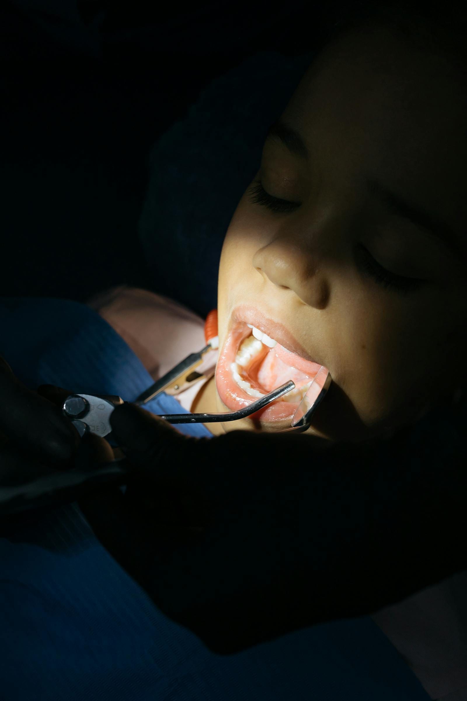 Pediatric Crown Restoration