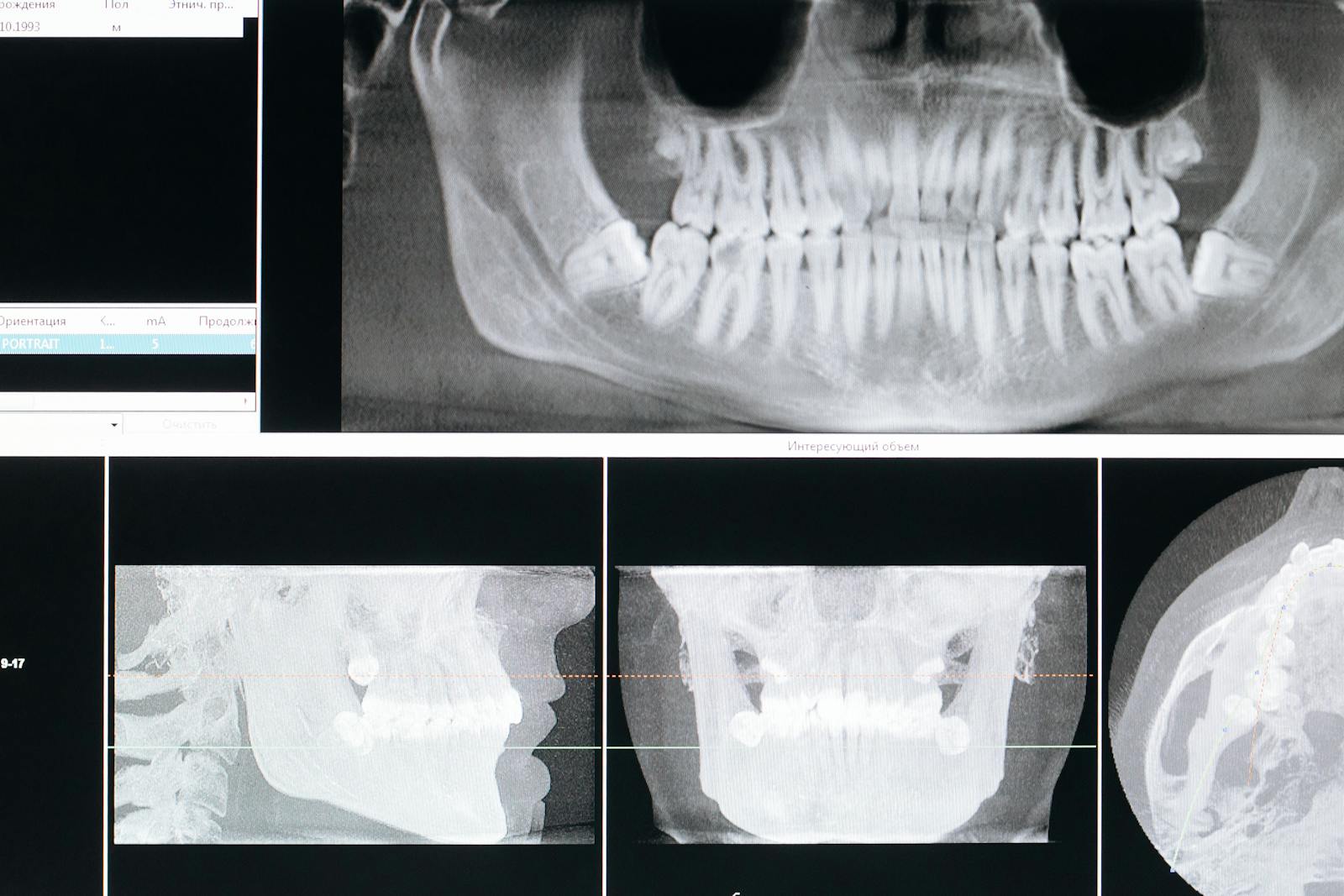 Dental Visiography
