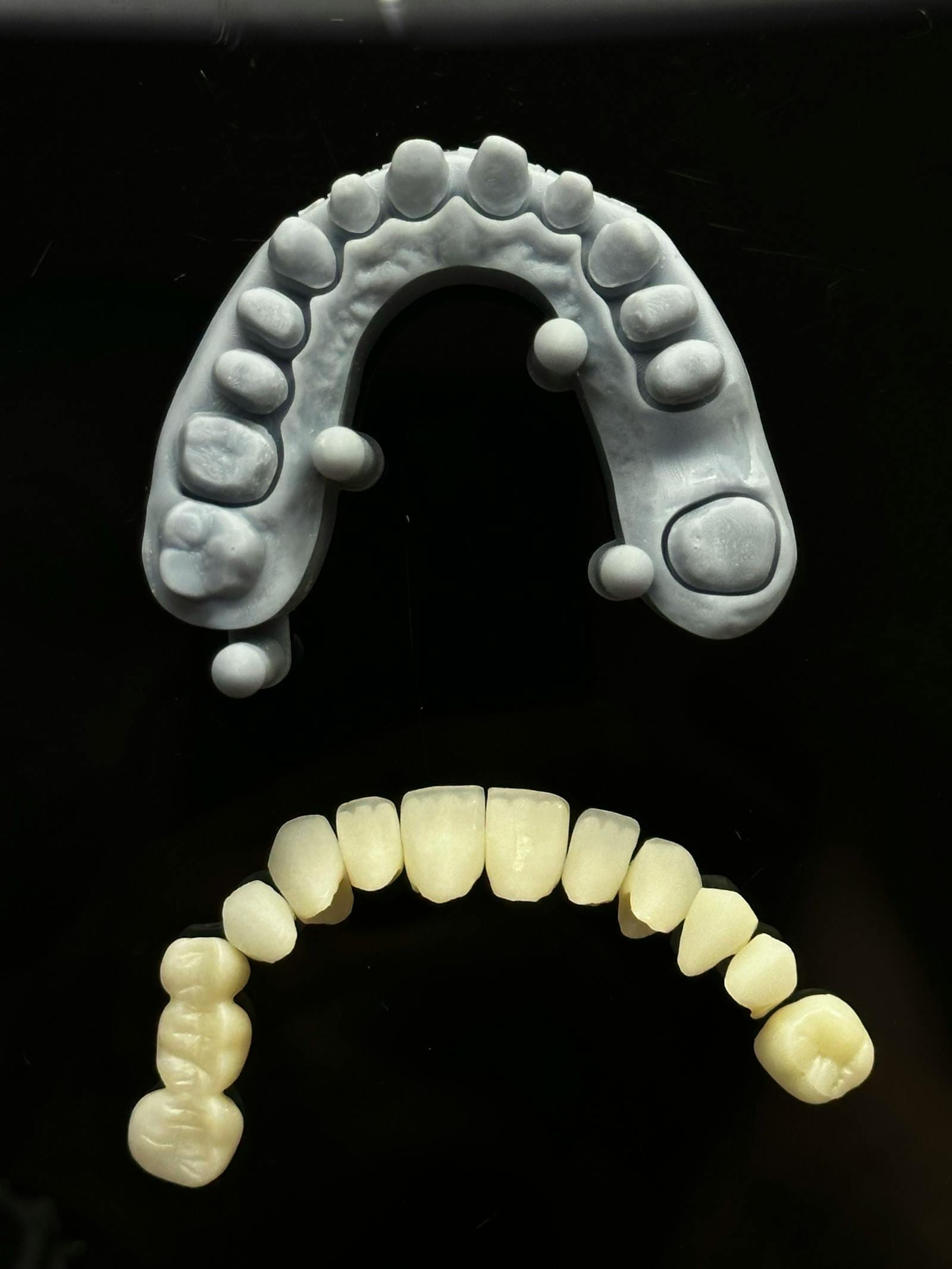 Zirconia Crown