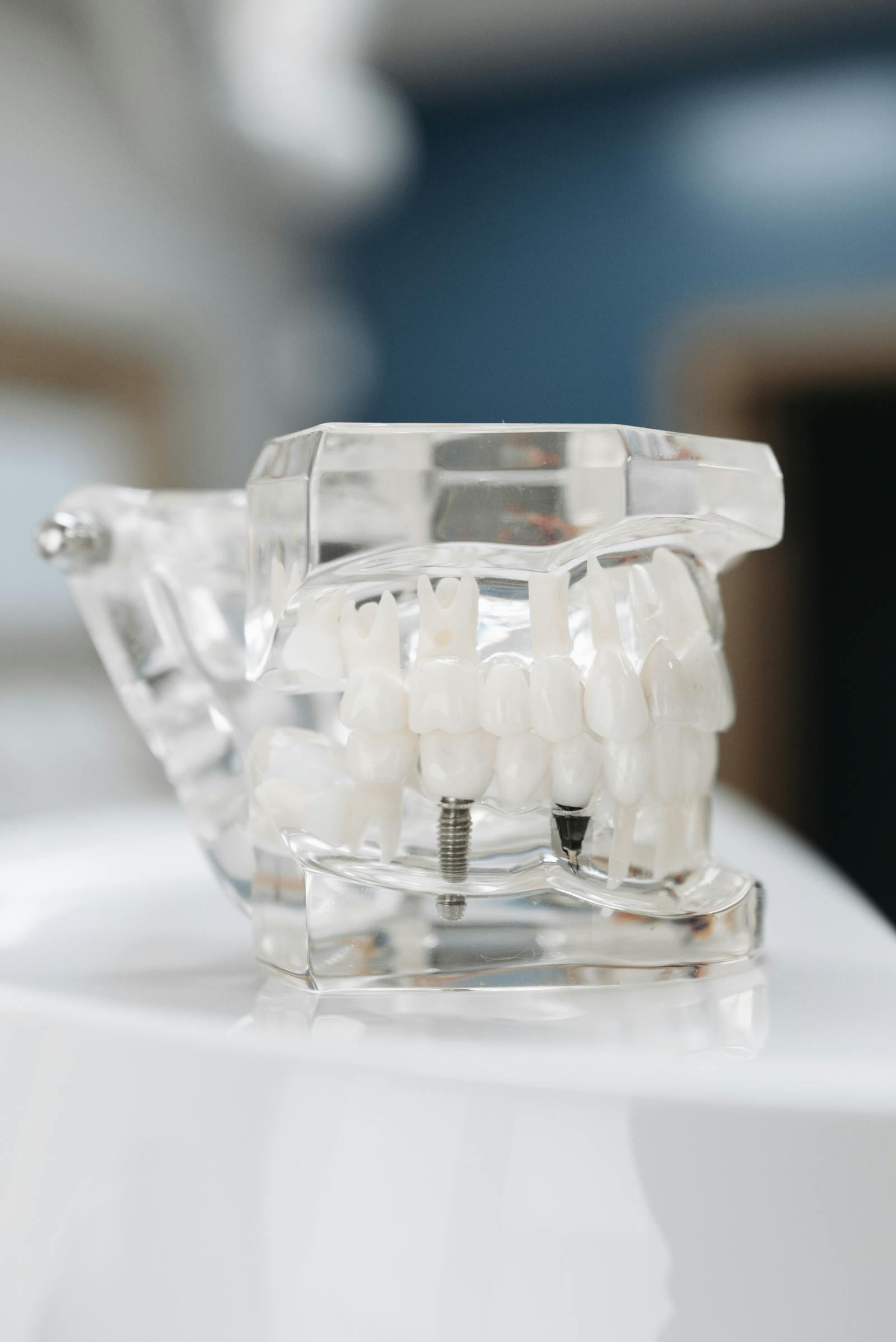 Straumann SLA Implant (Switzerland)