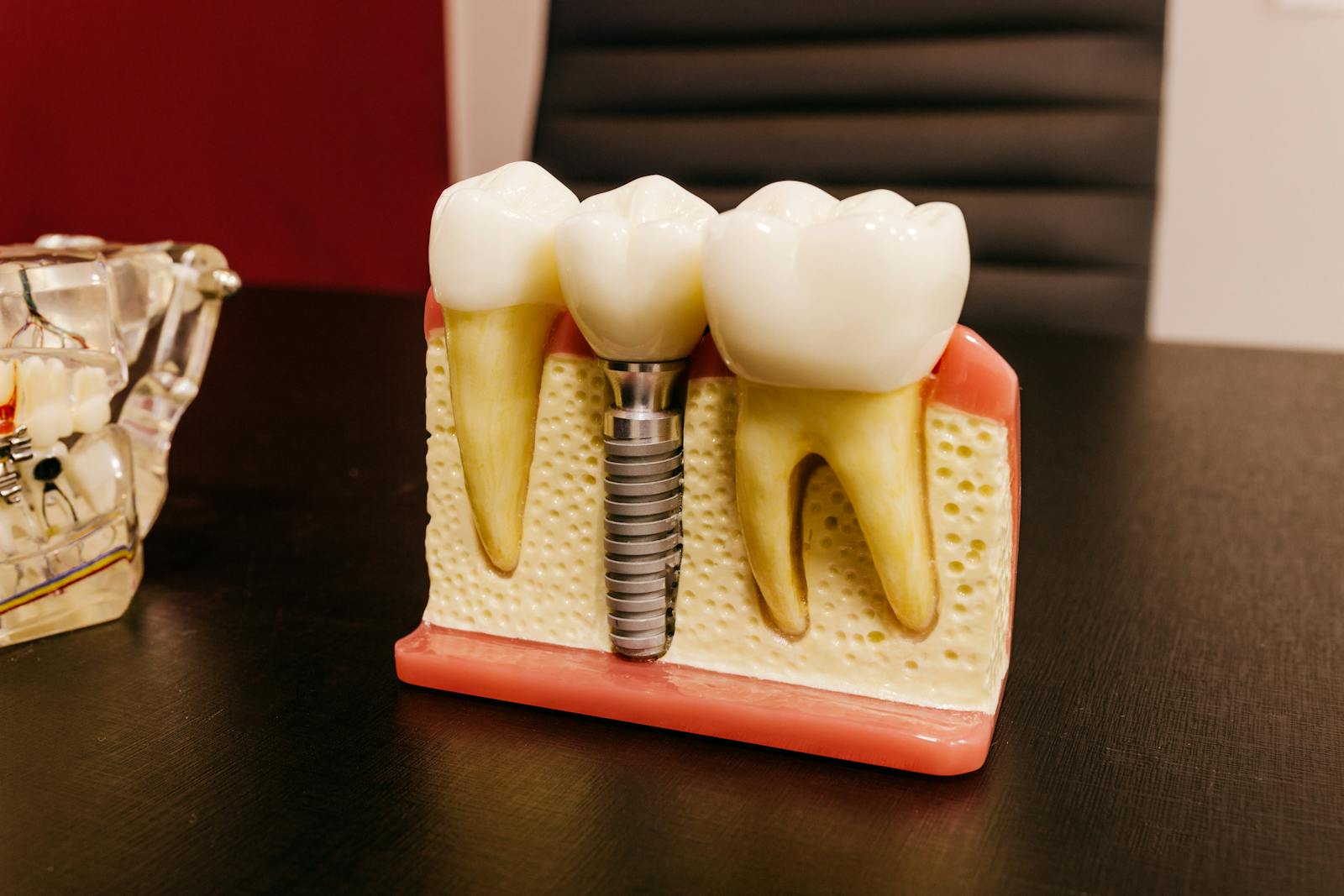 Inno Implant (Korea)