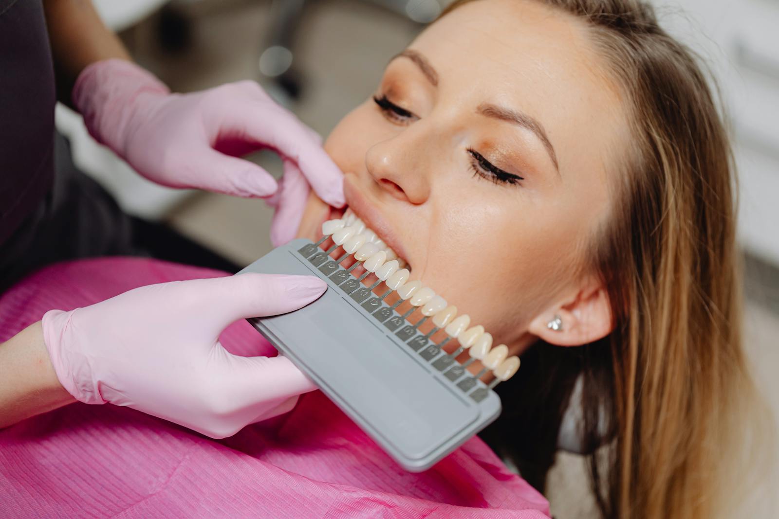 Aesthetic Restoration of Front Teeth