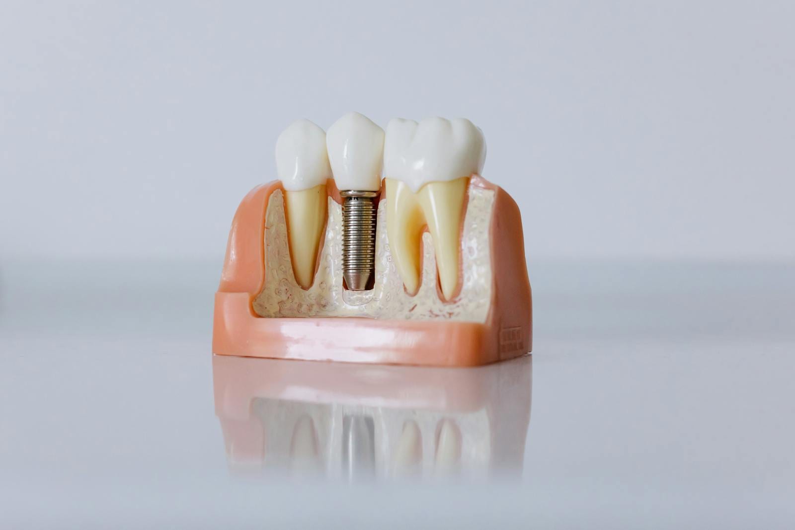 Medentika Implant (Germany)